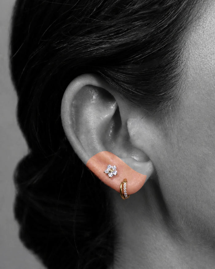 Upper Lobe